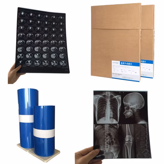 11X14 및 A3 Dicom 잉크젯 인쇄 초음파/방사선 필름